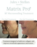 RF Microneedling