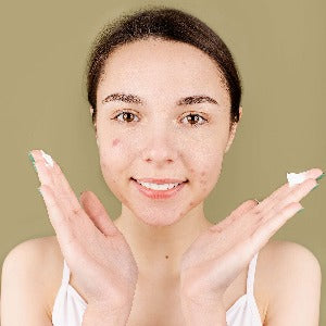 Teen Acne Treatment