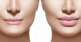 Injectables
