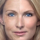 Skin Tightening