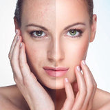 Photofacial
