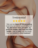 RF Microneedling