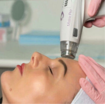 RF Microneedling