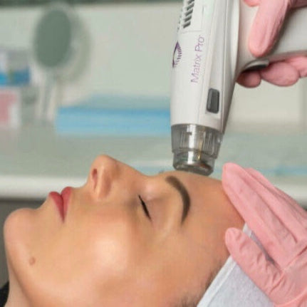 RF Microneedling